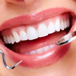 Everything You Want To Know About Cosmetic Dentistry