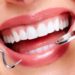 Everything You Want To Know About Cosmetic Dentistry