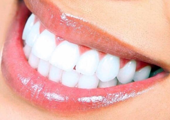 Be Proud Of Your Beautiful Shiny Smile
