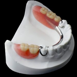 Removable Partial Dentures