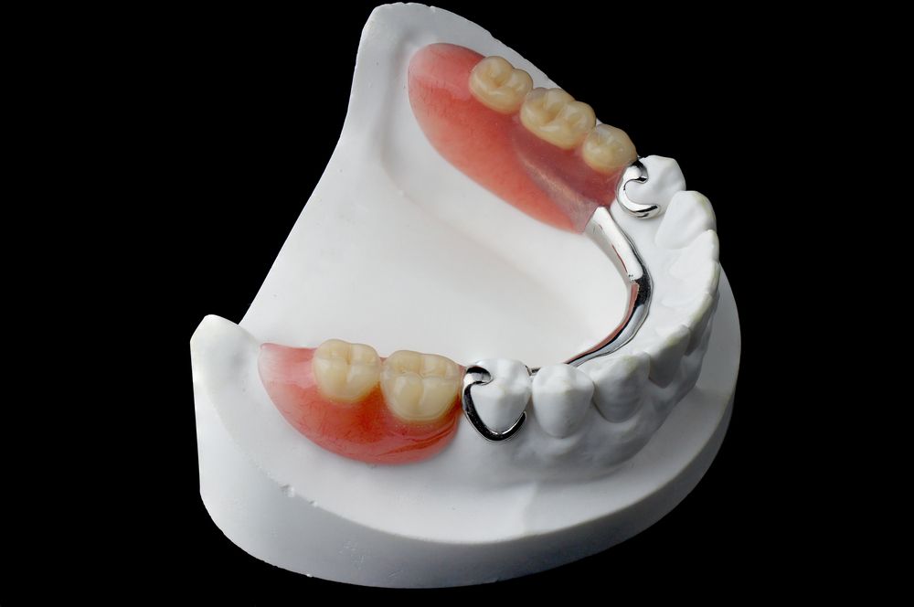 Partial-Dentures.jpg.optimal Removable Partial Dentures